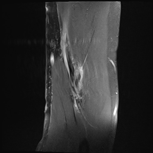 Click on the Serie image to view the images of Wieszt, Gnter